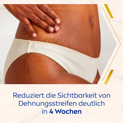 Artikelbild 3 für NIVEA LUMINOUS630® ANTI-DEHNUNGSSTREIFEN & PIGMENTFLECKEN Body Creme 200,0 ml, Artikelnummer 579447