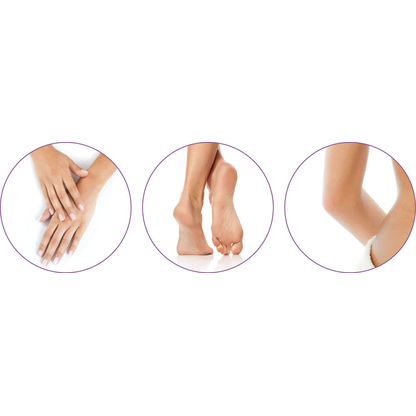 Artikelbild 2 für medisana CR 870 Elektrischer Hornhautentferner, Artikelnummer 858231