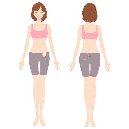 Artikelbild 9 für medisana TENS-Gerät TT 250 Menstruationsschmerz-Pad, 1 St., Artikelnummer 496491